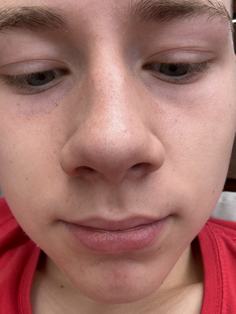 Zbliżenie na twarz osoby noszącej czerwoną odzież medyczną.